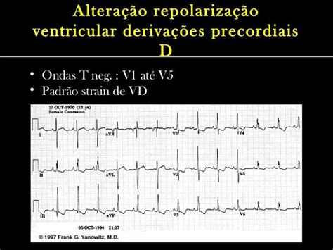 sobrecarga de vd.